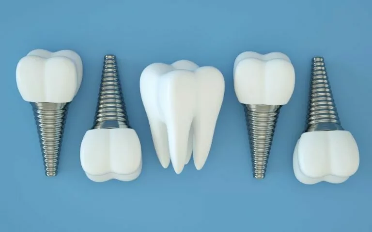 Dental implant screws